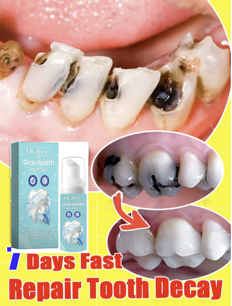Teeth Whitening Foam Toothpaste - Oralhoe 60ml Teeth Cleaning Mousse Foam