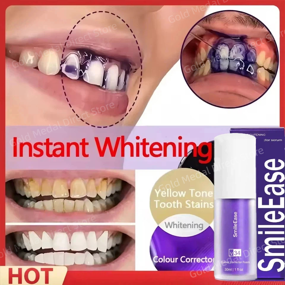 Teeth Whitening Crest - V34 Teeth Whitening Purple Toothpaste Remove