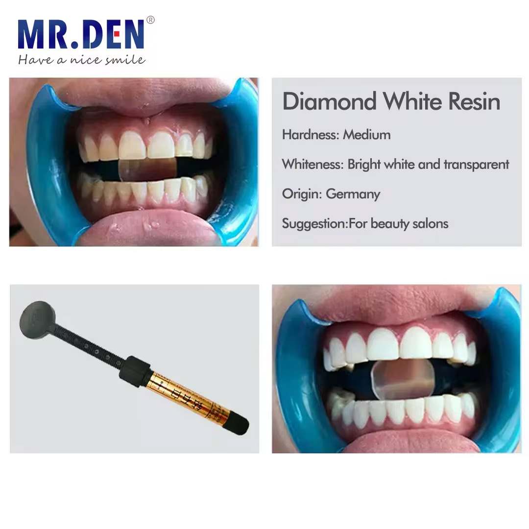 Teeth Whitening Kit Professional - Nano enamel veneer material teeth whitening
