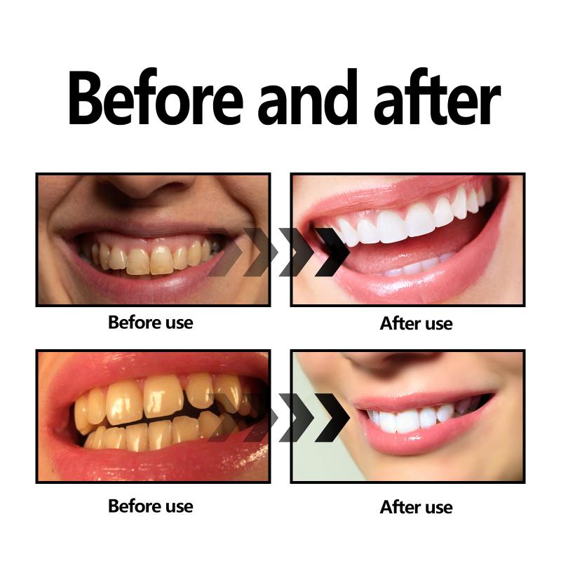 Teeth Whitening Powder Charcoa - Whitening Teeth Using Baking Soda incelemesi ve fiyatı