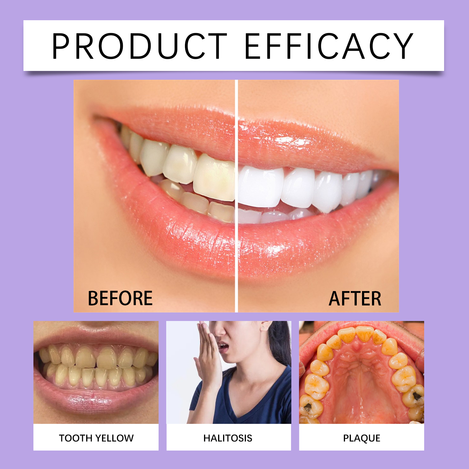 6ml Teeth Whitening Pen Teeth  - Teeth Whitening Serum incelemesi ve fiyatı