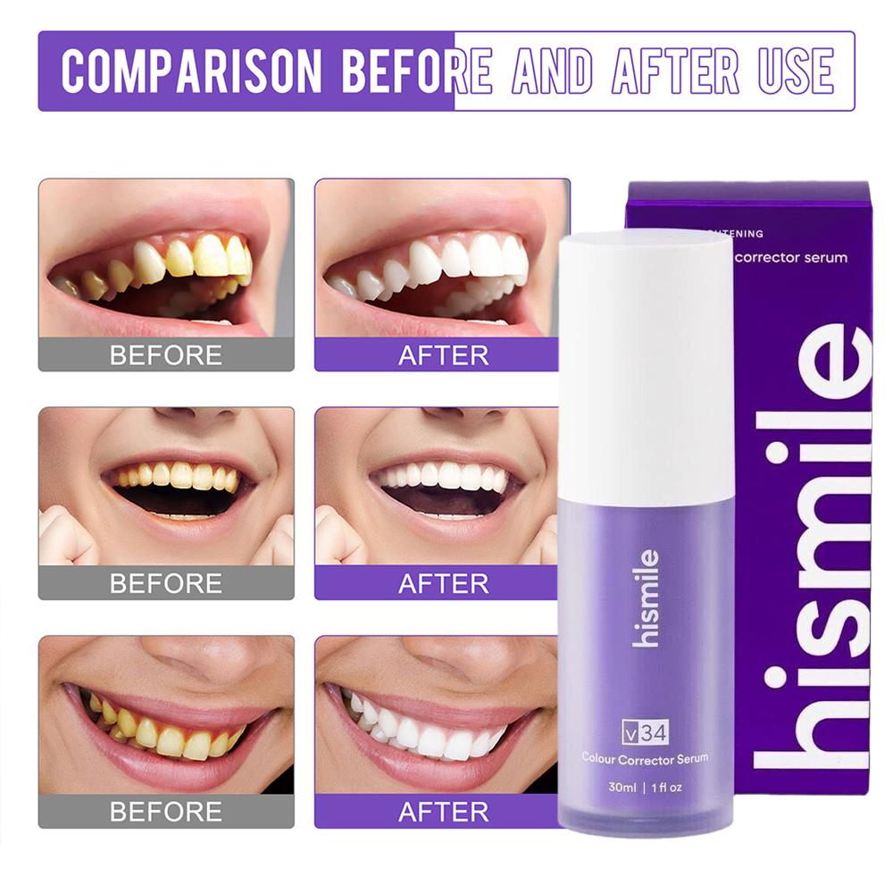 30ml Hismile V34 Purple Teeth  - Teeth Whitening Serum incelemesi ve fiyatı
