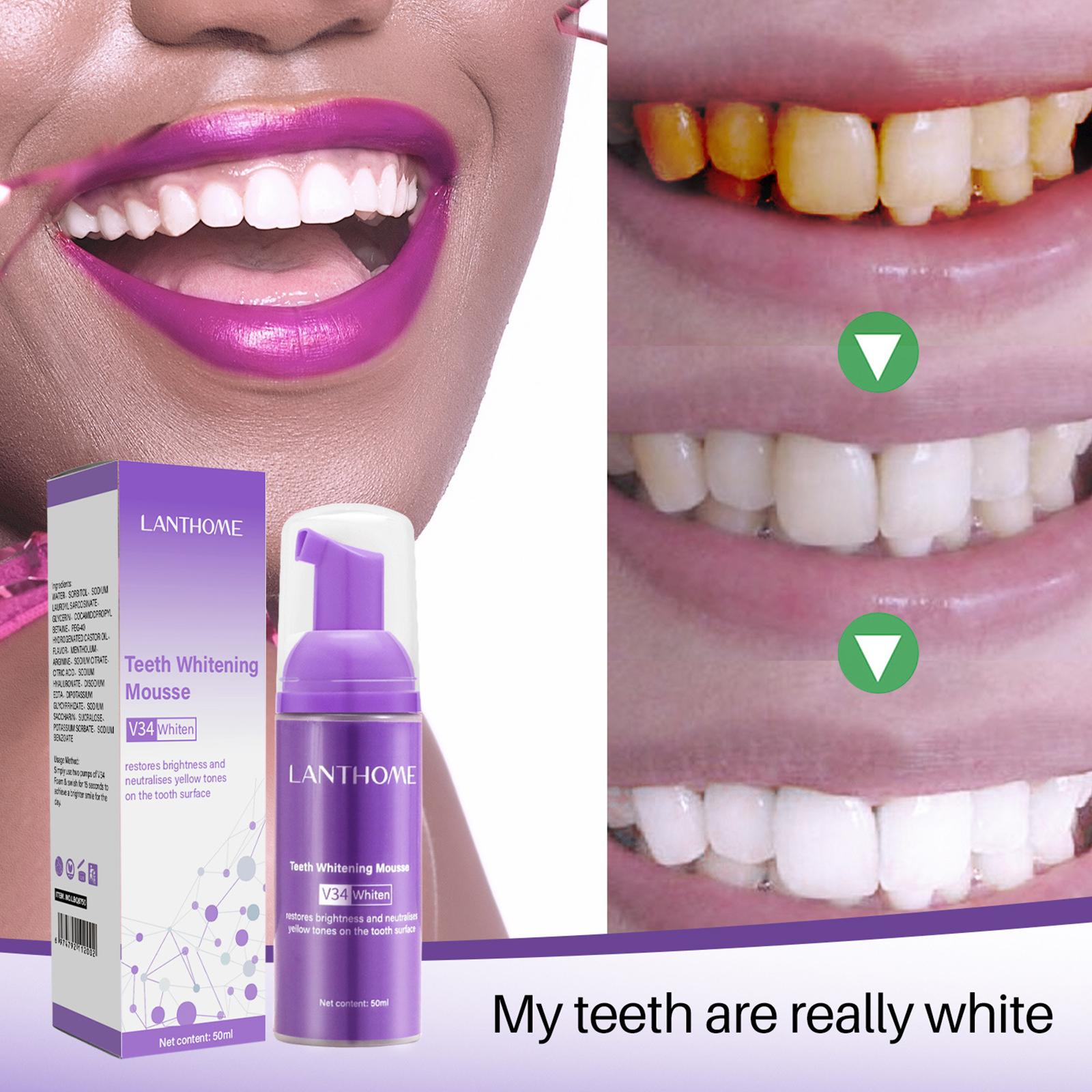 V34 Mousse Teeth Cleaning Toot - Teeth Whitening Crest incelemesi ve fiyatı