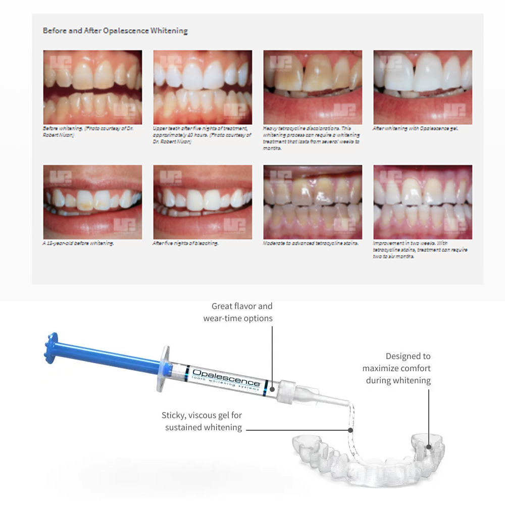 Opalescence Whitening 20% PF 2 - Whitening Mouthwash incelemesi ve fiyatı