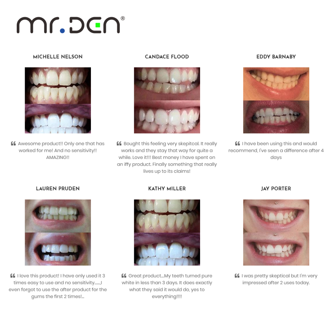 Dr. Whiten 3 Pack Teeth Whiten - Teeth Whitening Kit Professional incelemesi ve fiyatı