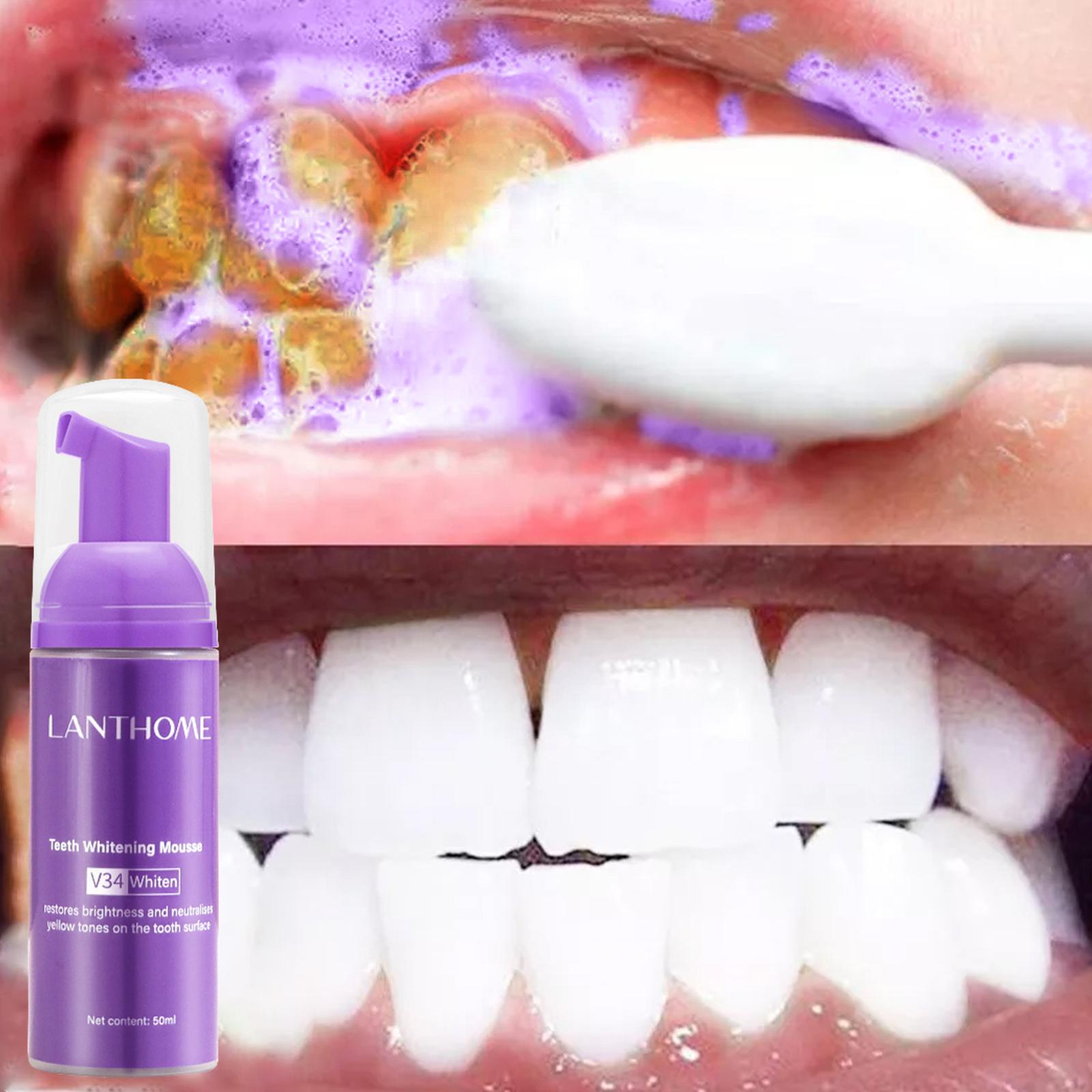 50MLTeeth Whitening Mousse Rem - Teeth Whitening Foam Toothpaste incelemesi ve fiyatı