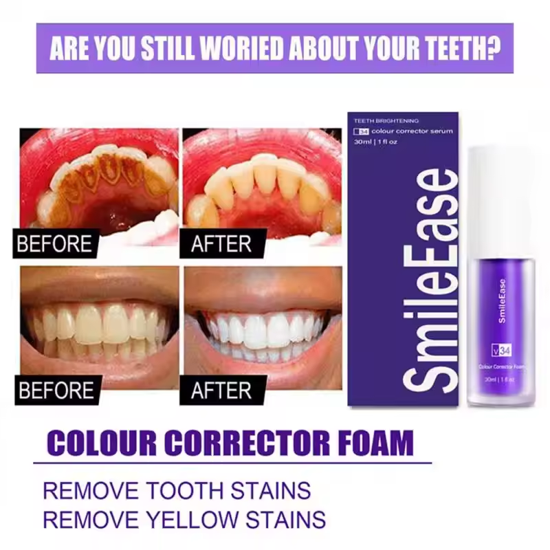 V34 Teeth Whitening Purple Too - Teeth Whitening Crest incelemesi ve fiyatı