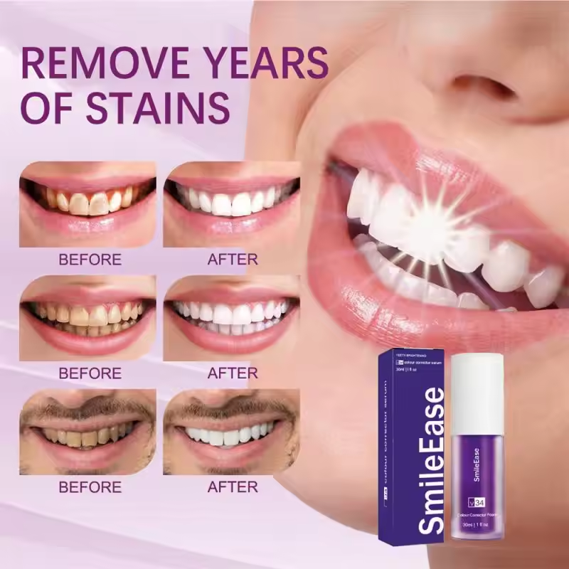 V34 Teeth Whitening Purple Too - Teeth Whitening Crest incelemesi ve fiyatı