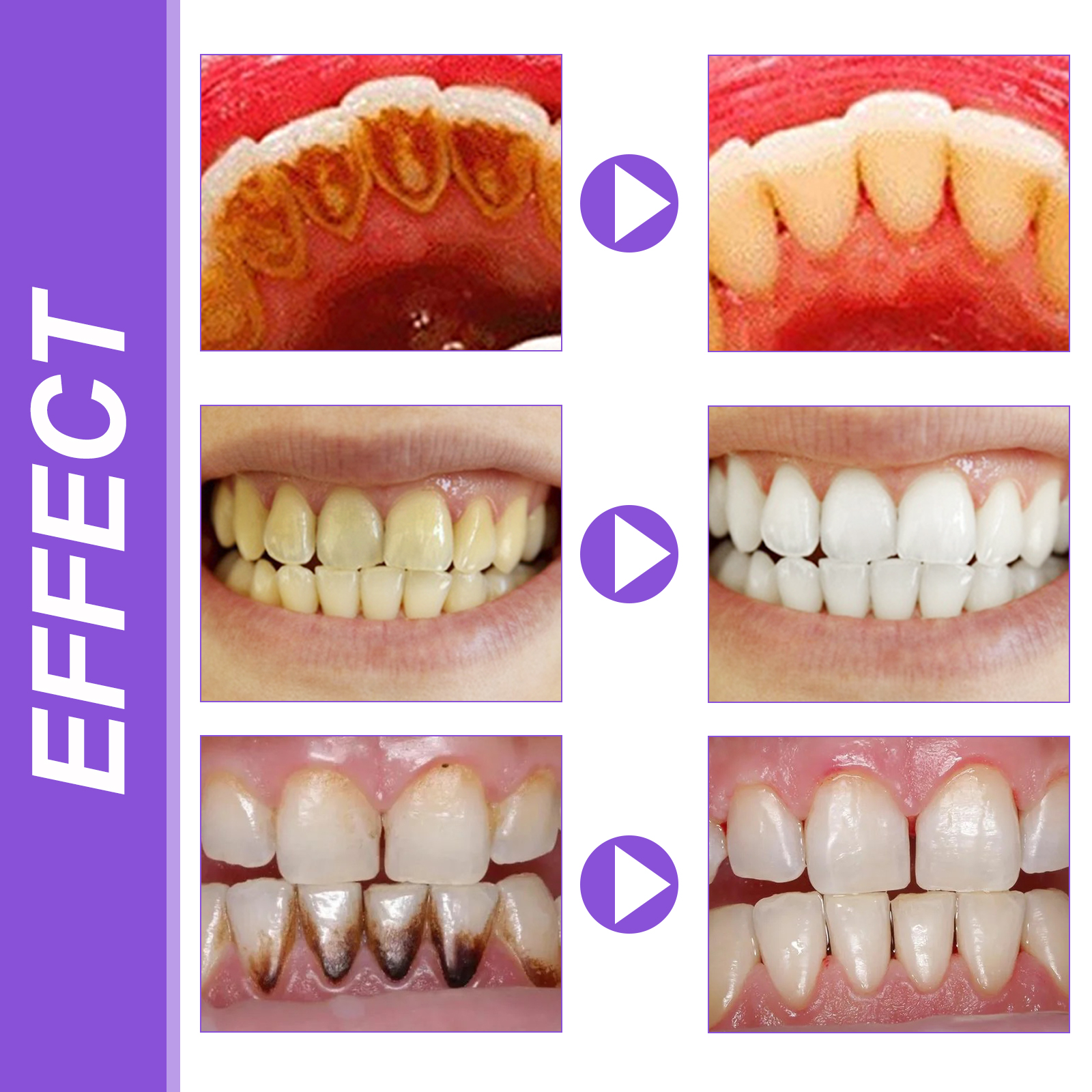 EELHOE Smiles Bright White Ref - Teeth Whitening Serum incelemesi ve fiyatı