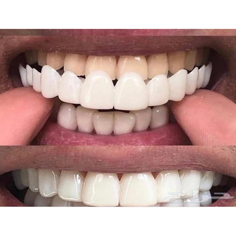 Graduation Photo Special Teeth - Teeth Whitening For Photos incelemesi ve fiyatı