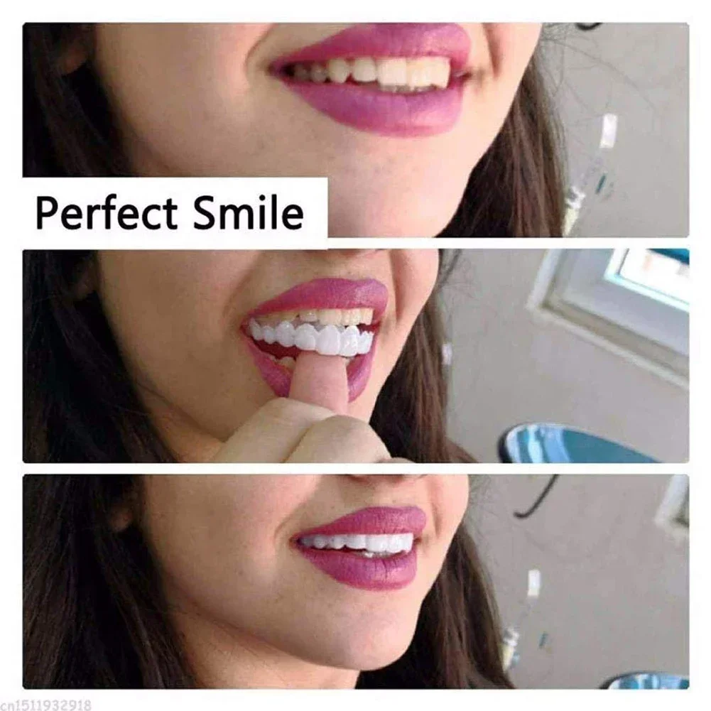 Pet Owner Teeth Veneers Reusab - Teeth Whitening For Photos incelemesi ve fiyatı