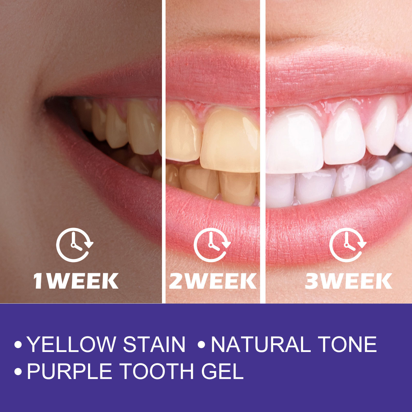 Purple Toothpaste Teeth Whiten - Teeth Whitening Crest incelemesi ve fiyatı