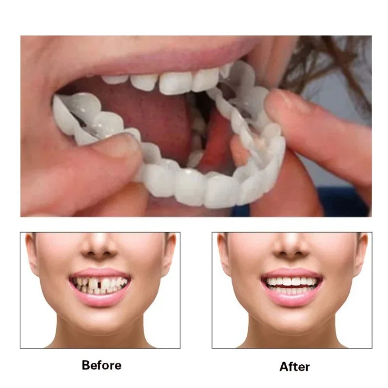 Perfect Family Photo Smile Tee - Teeth Whitening For Photos incelemesi ve fiyatı