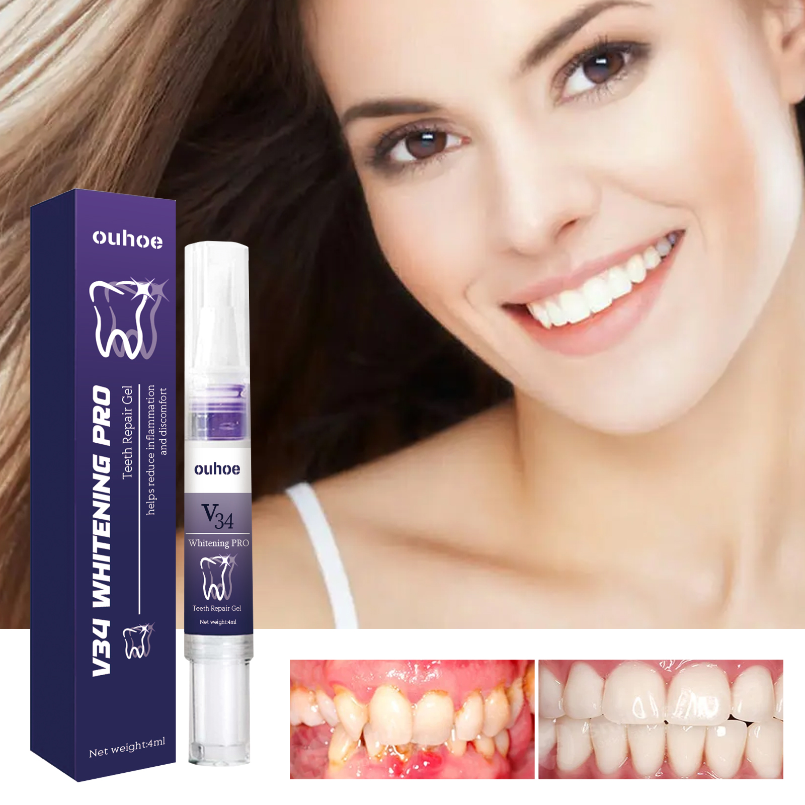Rapid Repair Damaged Gums Gel  - Teeth Whitening Serum incelemesi ve fiyatı