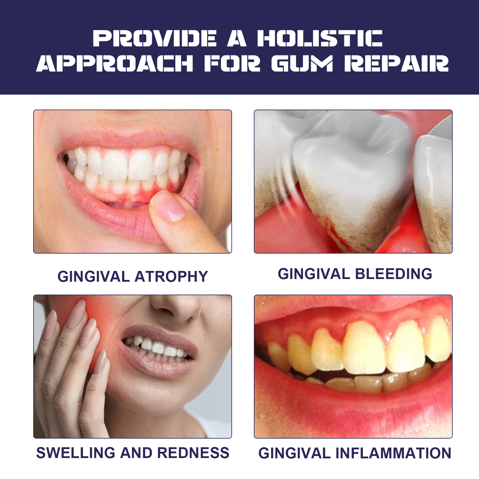 Rapid Repair Damaged Gums Gel  - Teeth Whitening Serum incelemesi ve fiyatı