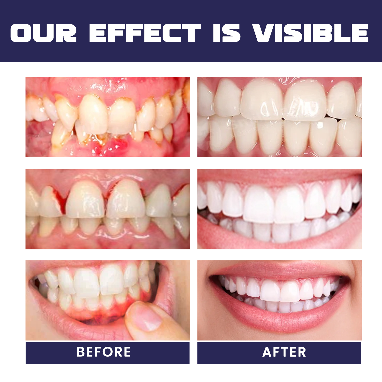 Rapid Repair Damaged Gums Gel  - Teeth Whitening Serum incelemesi ve fiyatı
