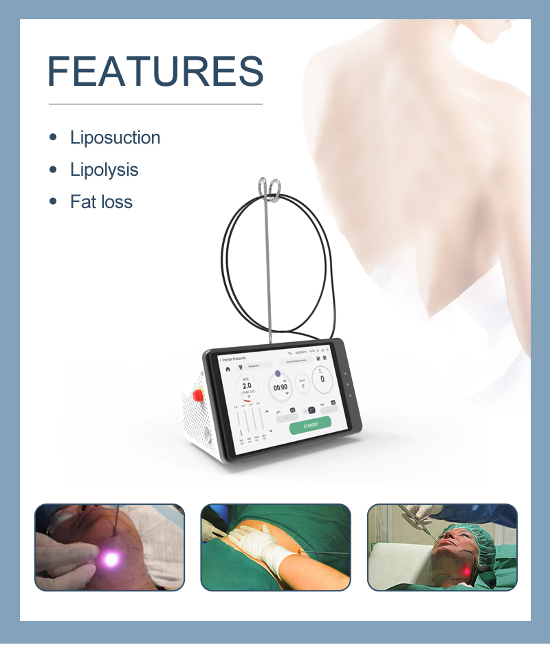 Dental Laser Teeth Whitening D - Teeth Whitening Laser incelemesi ve fiyatı