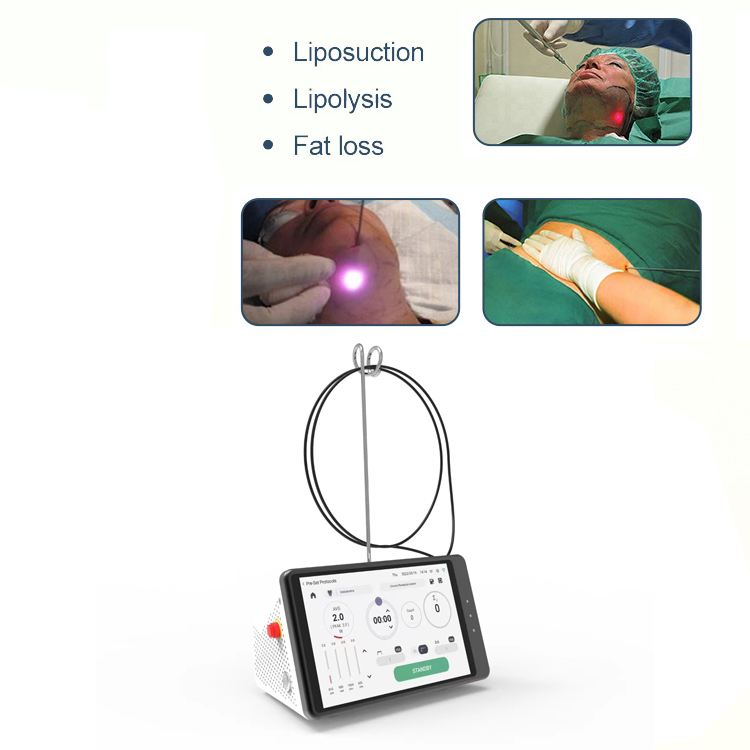 Dental Laser Teeth Whitening D - Teeth Whitening Laser incelemesi ve fiyatı