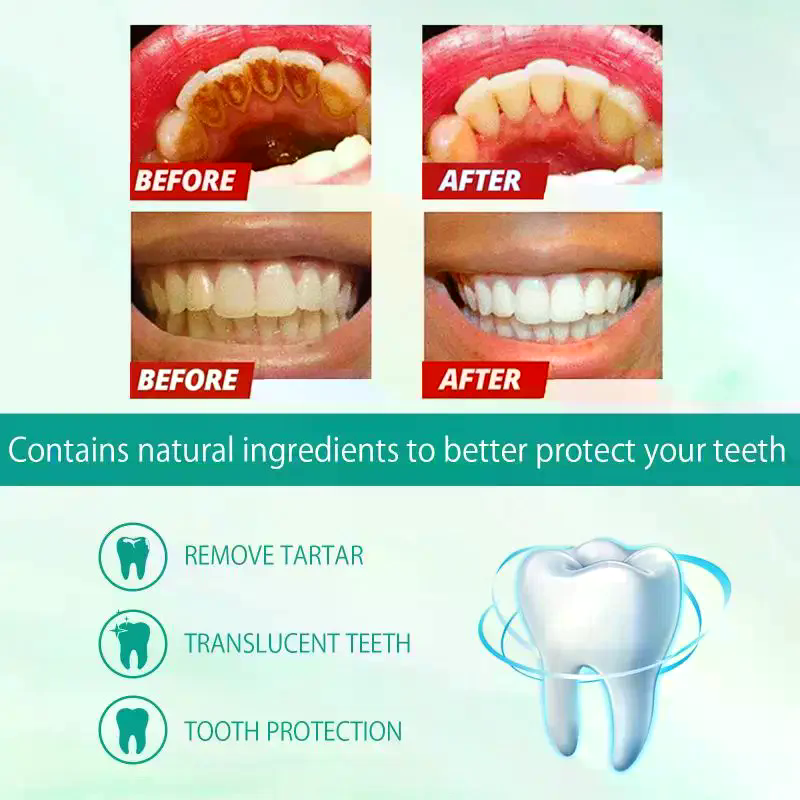 Whitening Foam Toothpaste Clea - Teeth Whitening Foam Toothpaste incelemesi ve fiyatı
