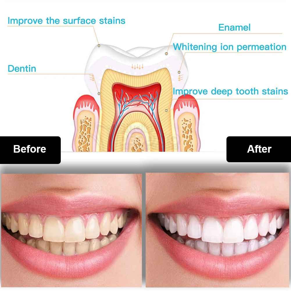 Dental Teeth Whitening Kit Min - Whitening Mouthwash incelemesi ve fiyatı
