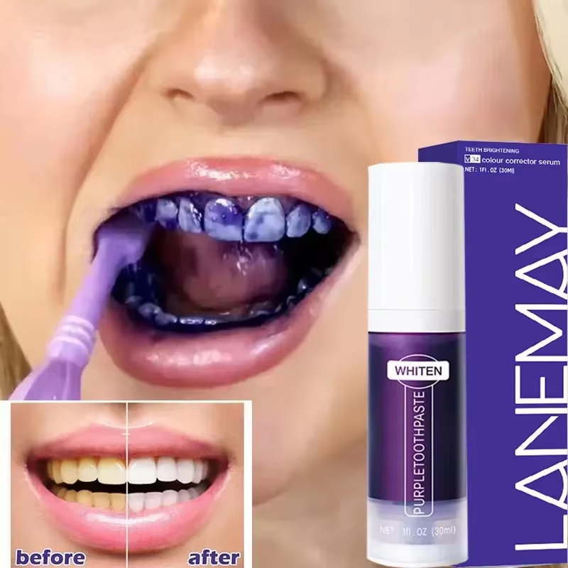 V34 Purple Teeth Whitening Too - Teeth Whitening Crest incelemesi ve fiyatı