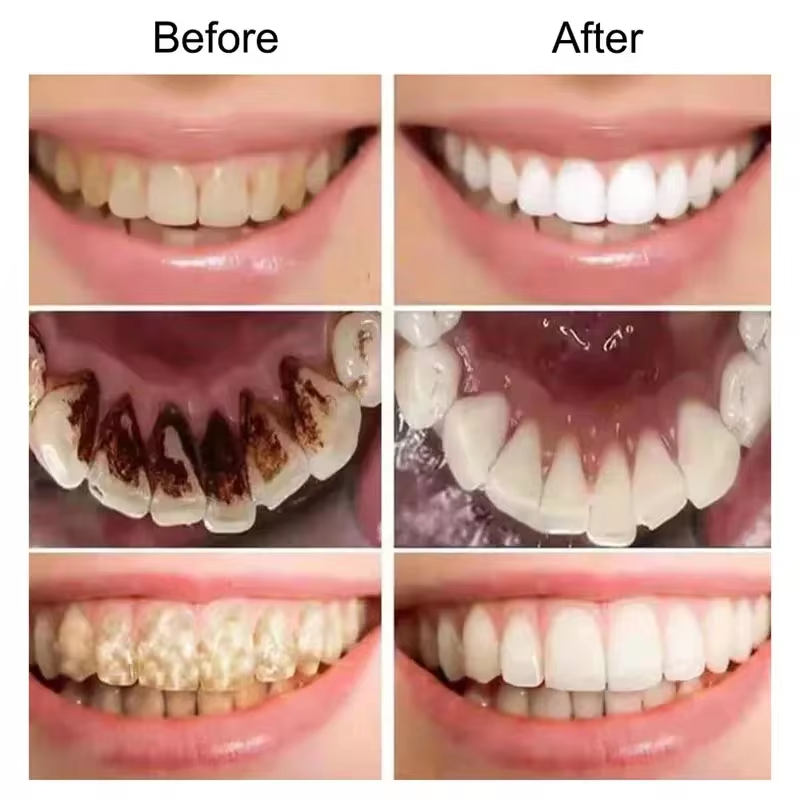 V34 Purple Teeth Whitening Too - Teeth Whitening Crest incelemesi ve fiyatı