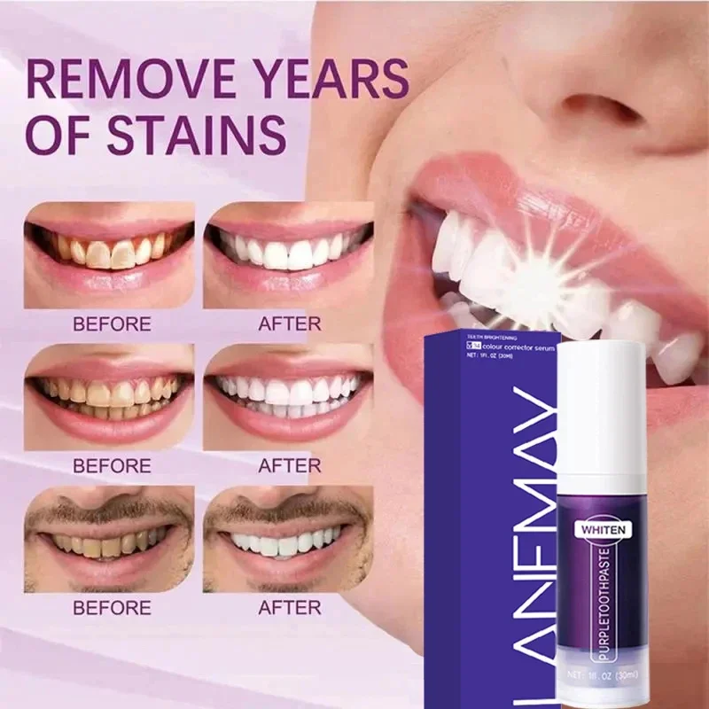 V34 Purple Teeth Whitening Too - Teeth Whitening Crest incelemesi ve fiyatı