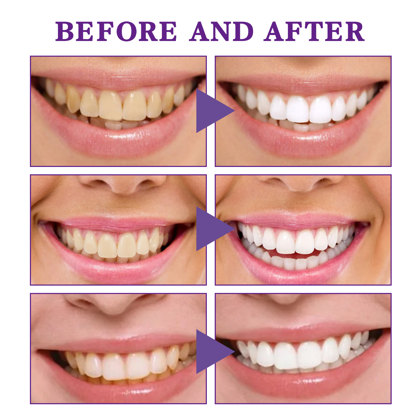 V34 Cleansing Mousse, Intensiv - Teeth Whitening Crest incelemesi ve fiyatı