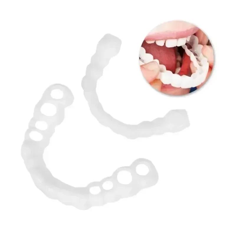 New Newlywed Couple Teeth Vene - Teeth Whitening For Photos incelemesi ve fiyatı