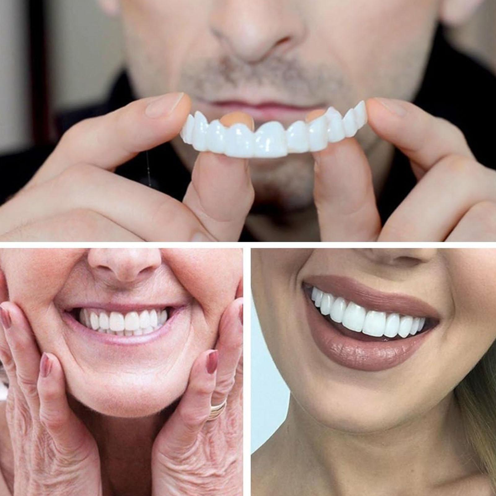 Camera Shy Person Teeth Veneer - Teeth Whitening For Photos incelemesi ve fiyatı