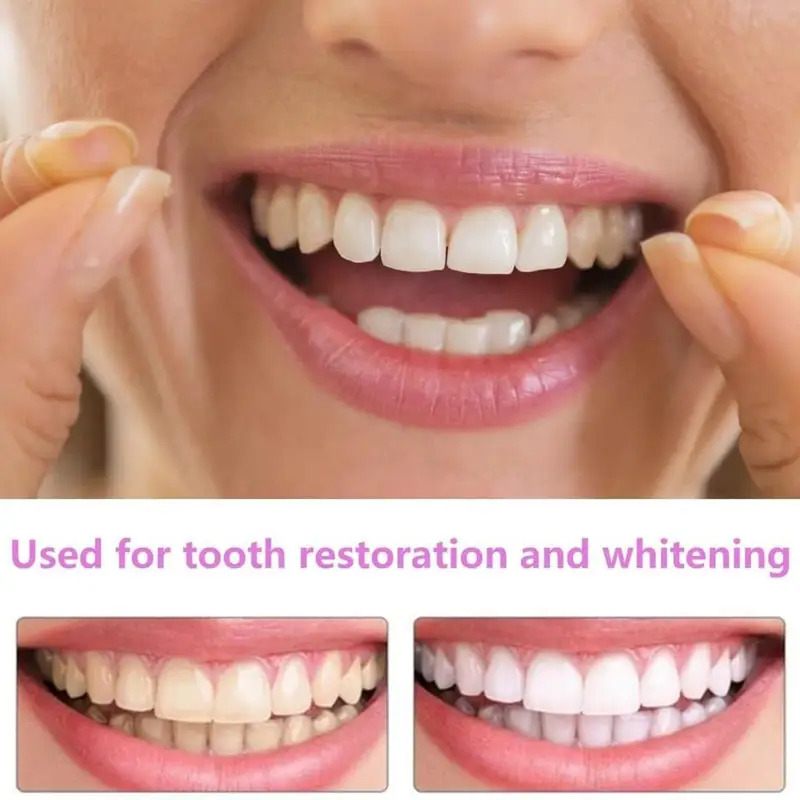 New Pet Owner Teeth Veneers Re - Teeth Whitening For Photos incelemesi ve fiyatı