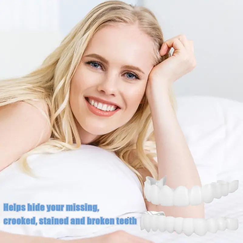 New Pet Owner Teeth Veneers Re - Teeth Whitening For Photos incelemesi ve fiyatı