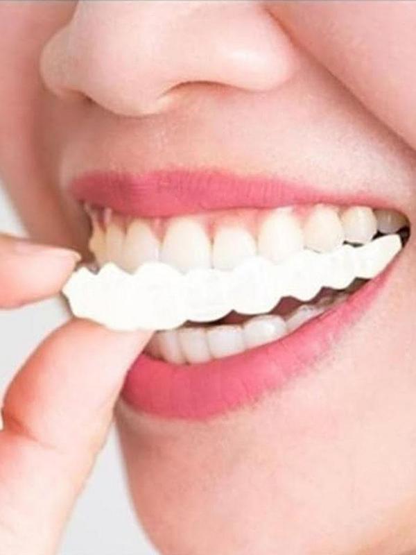 Pet Owner Teeth Veneers Reusab - Teeth Whitening For Photos incelemesi ve fiyatı