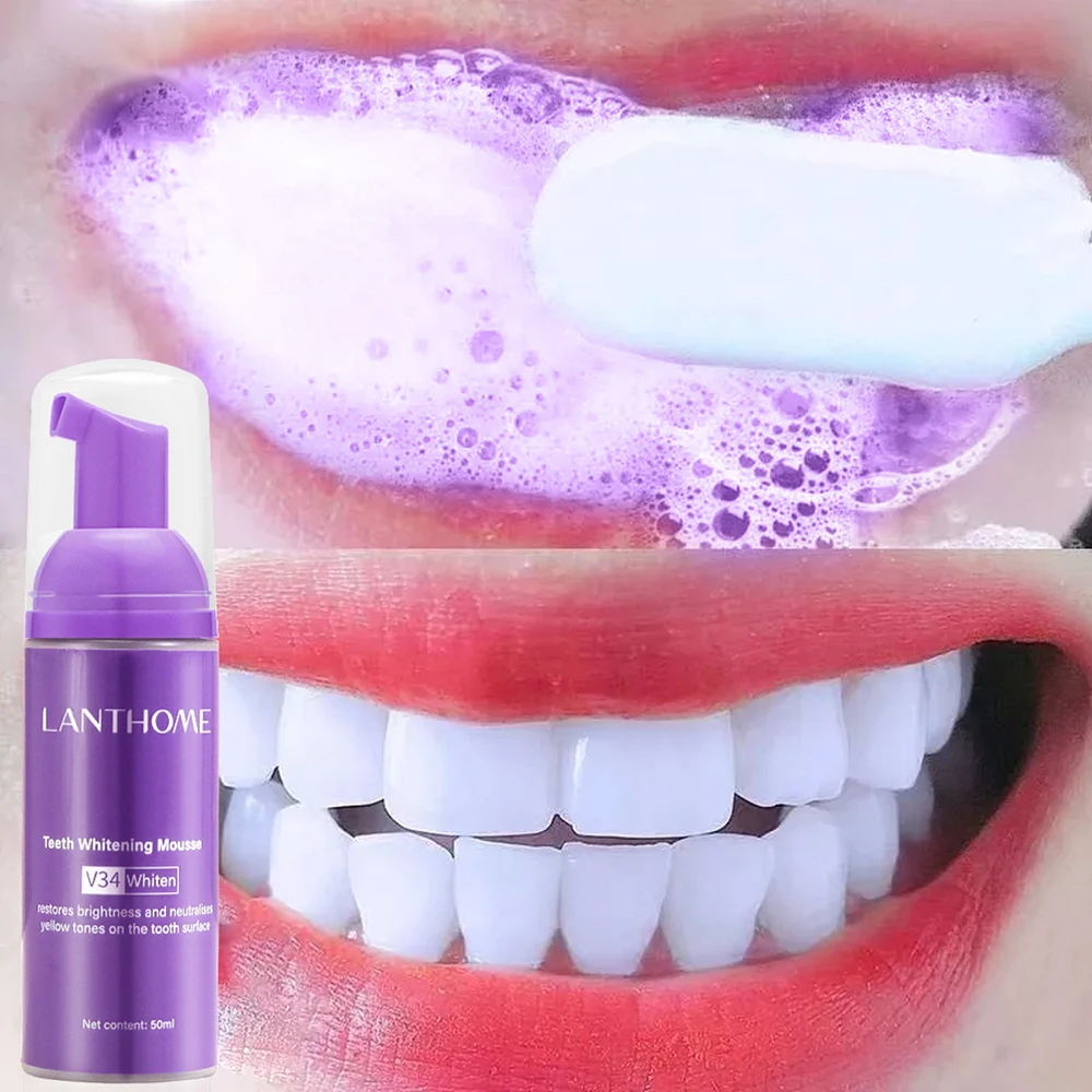 Mousse V34 Toothpaste Teeth Cl - Teeth Whitening Crest incelemesi ve fiyatı