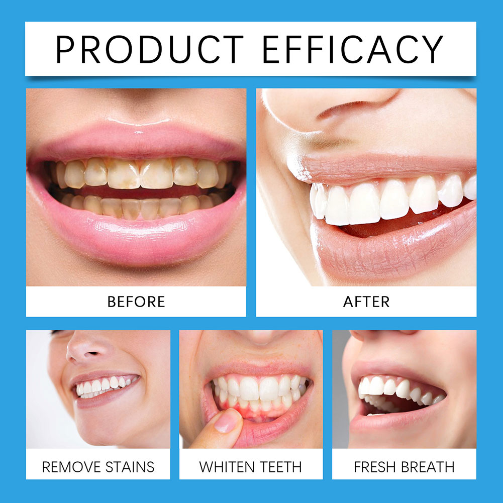 Professional Teeth Stain Remov - Teeth Whitening For Photos incelemesi ve fiyatı